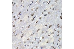Immunohistochemistry of paraffin-embedded mouse brain using PSMB10 antibody (ABIN6132527, ABIN6146311, ABIN6146312 and ABIN6221107) at dilution of 1:200 (40x lens). (PSMB10 antibody  (AA 1-273))