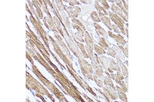 Immunohistochemistry of paraffin-embedded rat heart using NPPA Rabbit pAb (ABIN7268829) at dilution of 1:100 (40x lens). (NPPA antibody  (AA 26-151))