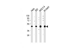 All lanes : Anti-MTHFD2 Antibody (C-term) at 1:4000 dilution Lane 1: Hela whole cell lysate Lane 2: 293 whole cell lysate Lane 3: MOLT-4 whole cell lysate Lane 4: Mouse heart lysate Lysates/proteins at 20 μg per lane. (MTHFD2 antibody  (C-Term))