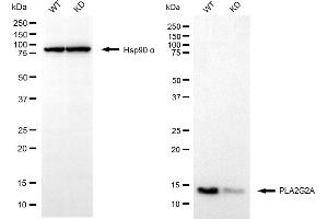 Western blotting analysis using PLA2G2A antibody (ABIN7799821). (Recombinant PLA2G2A antibody)