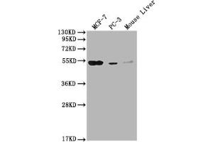 Western Blot Positive WB detected in: MCF-7 whole cell lysate, PC-3 whole cell lysate, Mouse Liver tissue All lanes: MOCS3 antibody at 1:2000 Secondary Goat polyclonal to rabbit IgG at 1/50000 dilution Predicted band size: 50 kDa Observed band size: 50 kDa (MOCS3 antibody  (AA 279-404))