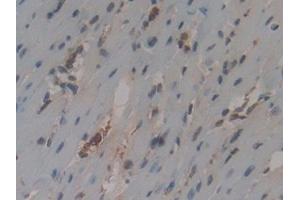 Detection of CYCS in Mouse Heart Tissue using Polyclonal Antibody to Cytochrome C (CYCS) (Cytochrome C antibody  (AA 13-99))