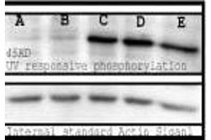 Phosphoserine, mouse spleen lysate, UV response. (Phosphoserine antibody)