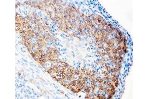 IHC-P: hCG receptor antibody testing of rat ovary tissue (hCG Receptor (N-Term) antibody)