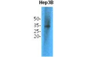 Western Blotting (WB) image for anti-Thiopurine S-Methyltransferase (TPMT) antibody (ABIN781549)