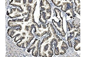 IHC analysis of ARG2 using anti-ARG2 antibody (ABIN7599304).