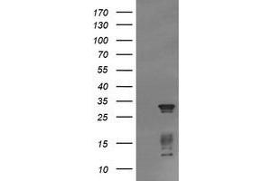 Image no. 2 for anti-Tripartite Motif Containing 38 (TRIM38) (AA 1-265) antibody (ABIN1490682) (TRIM38 antibody  (AA 1-265))
