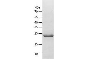 Western Blotting (WB) image for Nuclear Receptor Binding SET Domain Protein 1 (NSD1) (AA 1849-2094) protein (His tag) (ABIN7288402) (NSD1 Protein (AA 1849-2094) (His tag))