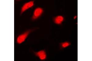Immunofluorescent analysis of PTTG1/2/3 staining in Jurkat cells. (PTTG1/2/3 antibody  (Center))
