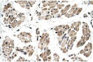 Immunohistochemical staining (Formalin-fixed paraffin-embedded sections) of human muscle with FKTN polyclonal antibody  at 4-8 ug/mL working concentration. (Fukutin antibody  (N-Term))