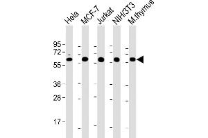 All lanes : Anti-Hsp60 Antibody at 1:2000 dilution Lane 1: Hela whole cell lysate Lane 2: MCF-7 whole cell lysate Lane 3: Jurkat whole cell lysate Lane 4: NIH/3T3 whole cell lysate Lane 5: mouse thymus lysate Lysates/proteins at 20 μg per lane. (HSPD1 antibody  (AA 340-374))