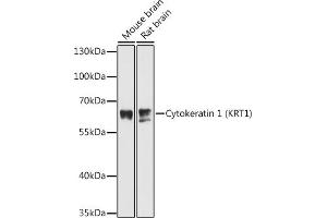Western blot analysis of extracts of various cell lines, using Cytokeratin 1 (Cytokeratin 1 (KRT1)) antibody (ABIN6127738, ABIN6143011, ABIN6143012 and ABIN6215521) at 1:3000 dilution. (Cytokeratin 1 antibody  (AA 200-450))