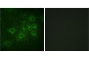 Immunofluorescence analysis of COS7 cells, using Synapsin1 (Phospho-Ser605) Antibody. (SYN1 antibody  (pSer605))