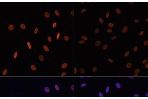 Immunofluorescence analysis of NIH/3T3 cells using Acetyl-Histone H2B-K12 Polyclonal Antibody at dilution of 1:100. (Histone H2B antibody  (acLys12))