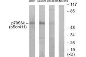 Western Blotting (WB) image for anti-Ribosomal Protein S6 Kinase, 70kDa, Polypeptide 1 (RPS6KB1) (pSer411) antibody (ABIN2888505) (RPS6KB1 antibody  (pSer411))