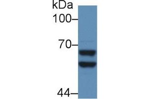 Detection of a2PI in Mouse Liver lysate using Polyclonal Antibody to Alpha 2-Antiplasmin (a2PI) (alpha 2 Antiplasmin antibody  (AA 348-491))