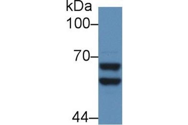 alpha 2 Antiplasmin Antikörper  (AA 348-491)