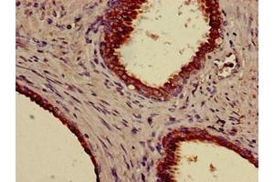 Immunohistochemistry (IHC) image for anti-Keratin 18 (KRT18) (AA 102-396) antibody (Biotin) (ABIN7157393)