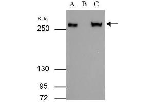 IP Image FASN antibody immunoprecipitates FASN protein in IP experiments. (Fatty Acid Synthase antibody  (N-Term))
