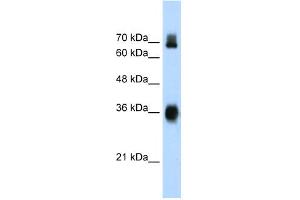 WB Suggested Anti-KEAP1 Antibody Titration:  1. (KEAP1 antibody  (C-Term))