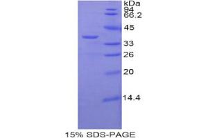 SDS-PAGE analysis of Mouse zAP70 Protein.