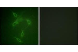 Immunofluorescence (IF) image for anti-Janus Kinase 2 (JAK2) (AA 541-590) antibody (ABIN1532352)