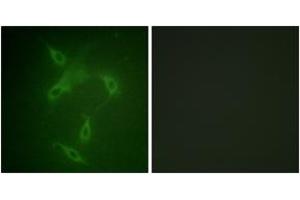 Immunofluorescence analysis of NIH-3T3 cells, using JAK2 (Ab-570) Antibody.