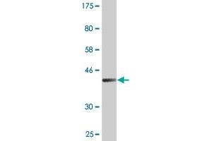 Western Blot detection against Immunogen (41. (TSC22D1 antibody  (AA 1-144))