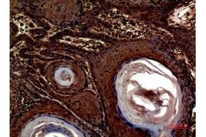 Immunohistochemistry (IHC) analysis of paraffin-embedded Human Skin, antibody was diluted at 1:100. (INHBA antibody  (C-Term))