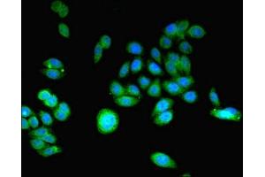 Immunofluorescent analysis of HepG2 cells using ABIN7148059 at dilution of 1:100 and Alexa Fluor 488-congugated AffiniPure Goat Anti-Rabbit IgG(H+L) (CCHCR1 antibody  (AA 483-782))