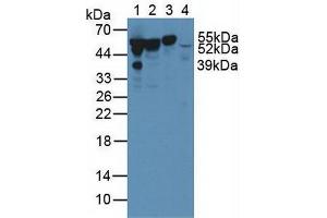 Figure. (Vitamin D-Binding Protein antibody  (AA 209-401))