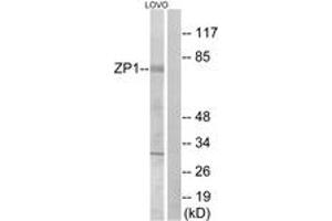 Western blot analysis of extracts from LOVO cells, using ZP1 Antibody.
