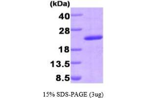 SDS-PAGE (SDS) image for Peptidylprolyl Isomerase G (Cyclophilin G) (PPIG) (AA 1-175) protein (His tag) (ABIN666915)