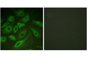 Immunofluorescence analysis of HeLa cells, using PLB (Ab-16/17) Antibody. (Phospholamban antibody  (AA 1-50))