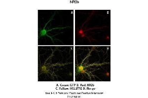 Sample Type :  Rat Hippocampal Neurons - 14DIV  Primary Antibody Dilution :  1:200  Secondary Antibody :  Anti-rabbit-Cy3  Secondary Antibody Dilution :  1:500  Color/Signal Descriptions :  Green: GFP Red: NR2b Yellow: VGLUT12  Gene Name :  GRIN2B  Submitted by :  Dan Fowler - University of Oregon, Institute of Neuroscience (GRIN2B antibody  (Middle Region))