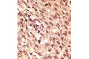 Image no. 1 for anti-Low Density Lipoprotein Receptor-Related Protein 5 (LRP5) (C-Term) antibody (ABIN358635)