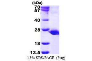 SDS-PAGE (SDS) image for Protein Tyrosine Phosphatase, Mitochondrial 1 (PTPMT1) (AA 28-201) protein (His tag) (ABIN667999) (PTPMT1 Protein (AA 28-201) (His tag))