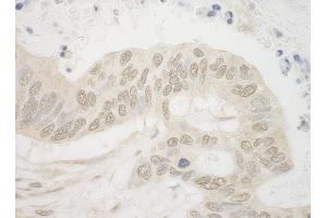 Immunohistochemistry (IHC) image for anti-Aryl Hydrocarbon Receptor Nuclear Translocator (ARNT) (AA 1-50) antibody (ABIN7453496)