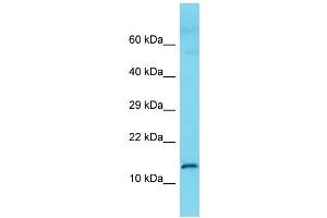 Host: Rabbit Target Name: C9orf57 Sample Type: Fetal Kidney lysates Antibody Dilution: 1. (C9ORF57 antibody  (N-Term))