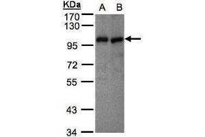 WB Image Sample(30 μg of whole cell lysate) A:MOLT4, B:Raji , 7. (VAV1 antibody  (Center))