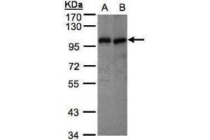 WB Image Sample(30 μg of whole cell lysate) A:MOLT4, B:Raji , 7.