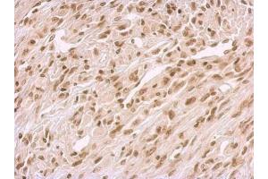 IHC-P Image BCCIP antibody detects BCCIP protein at nucleus on U373 xenograft by immunohistochemical analysis. (BCCIP antibody  (C-Term))