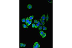 Immunofluorescent analysis of PC-3 cells using ABIN7164210 at dilution of 1:100 and Alexa Fluor 488-congugated AffiniPure Goat Anti-Rabbit IgG(H+L)