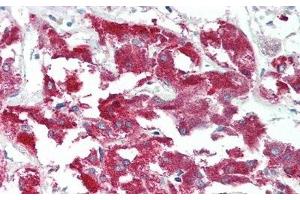Detection of MERTK in Human Adrenal gland Tissue using Polyclonal Antibody to C-Mer Proto Oncogene Tyrosine Kinase (MERTK)