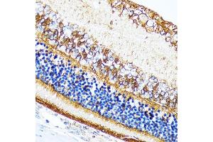 Immunohistochemistry of paraffin-embedded rat retina using CRALBP Rabbit mAb (ABIN7269934) at dilution of 1:100 (40x lens). (RLBP1 antibody)