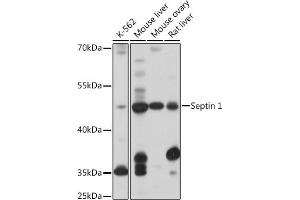 Western blot analysis of extracts of various cell lines, using Septin 1 antibody (ABIN7270202) at 1:1000 dilution. (Septin 1 antibody  (AA 270-370))