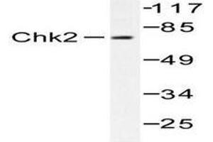 Image no. 1 for anti-Checkpoint Kinase 2 (CHEK2) antibody (ABIN265350) (CHEK2 antibody)