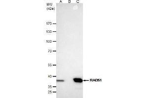 IP Image Rad51 antibody [N1C2] immunoprecipitates Rad51 protein in IP experiments. (RAD51 antibody  (Center))