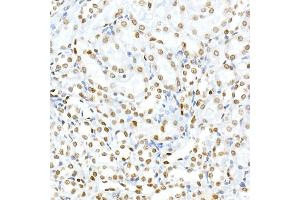 Immunohistochemistry of paraffin-embedded rat kidney using Phospho-Histone H3. (Histone H3.3 antibody  (pSer31))
