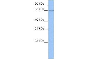 WB Suggested Anti-NOL5A Antibody Titration: 1 ug/mlPositive Control: 721_B cell lysate NOP56 is supported by BioGPS gene expression data to be expressed in 721_B